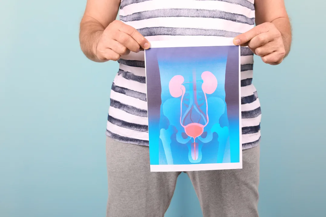 5 Common Urological Issues (And How to Prevent Them)